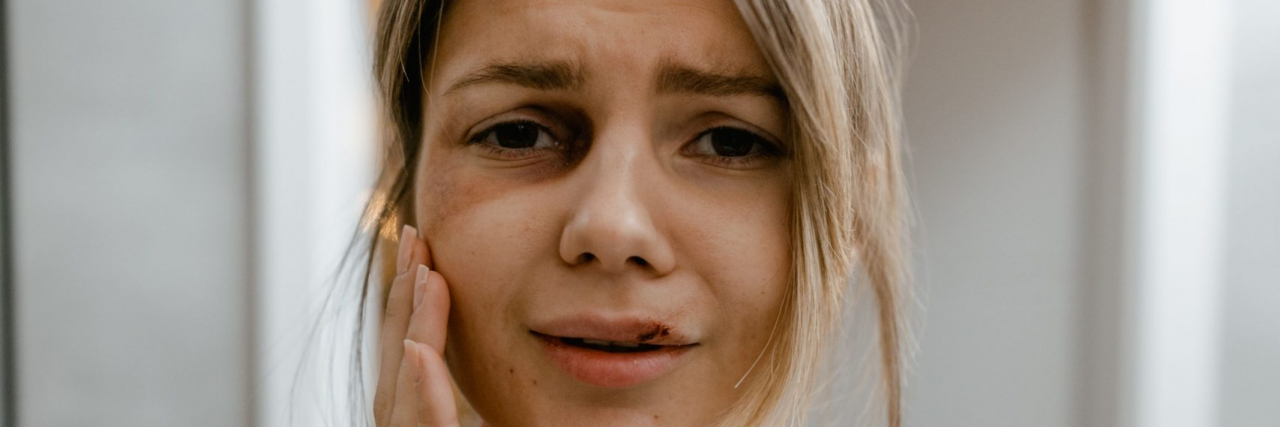 Person with molar pain